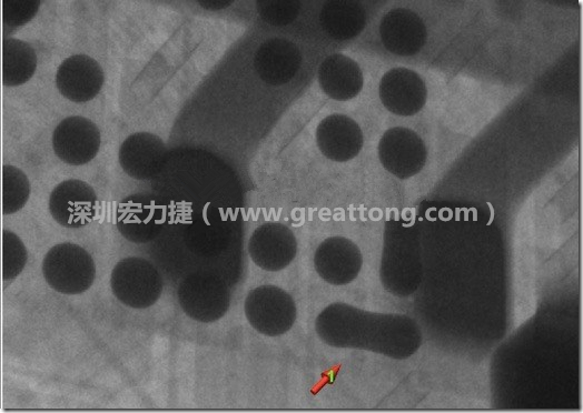 BGA因?yàn)楹笁|變小，造成錫膏過多而最終形成焊接短路的結(jié)果。